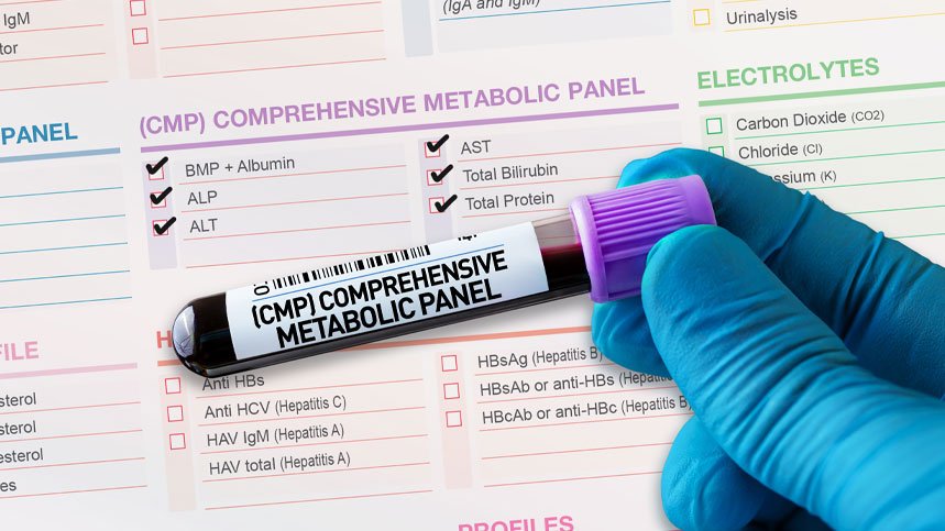 Full Metabolic Panel