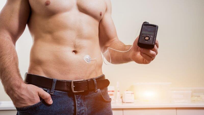 Insulin Pump Therapy