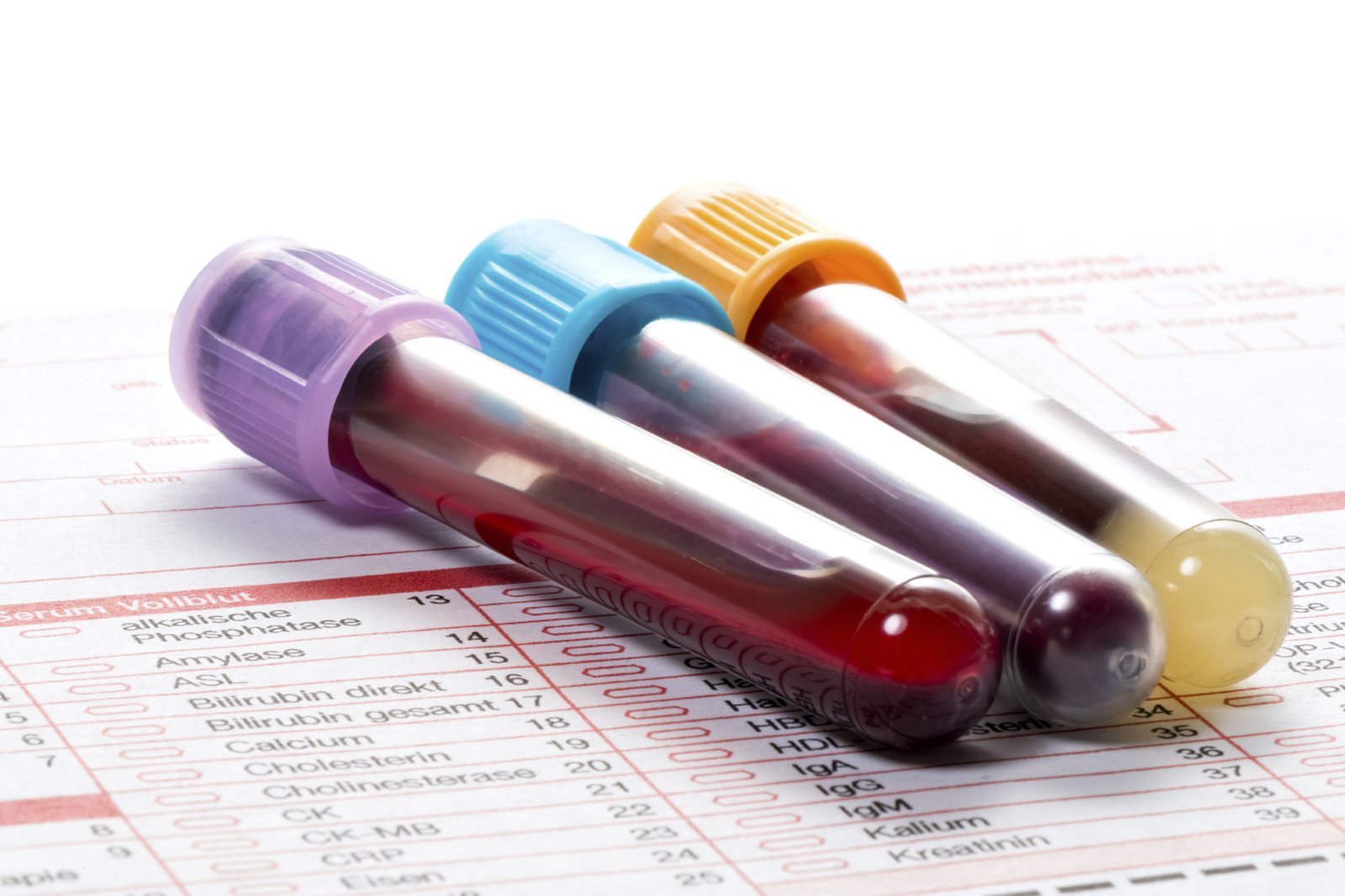 Abnormal Blood Tests