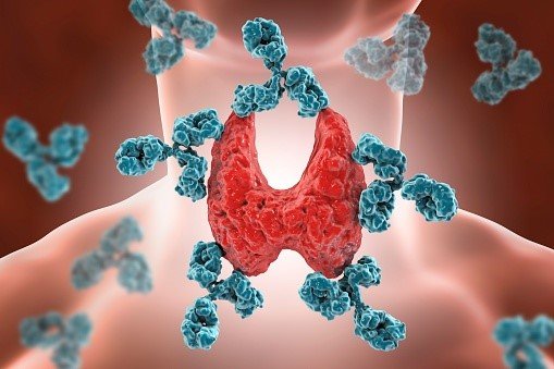 Thyroiditis