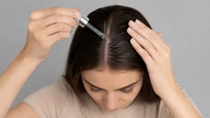 PCOS Hair Thinning