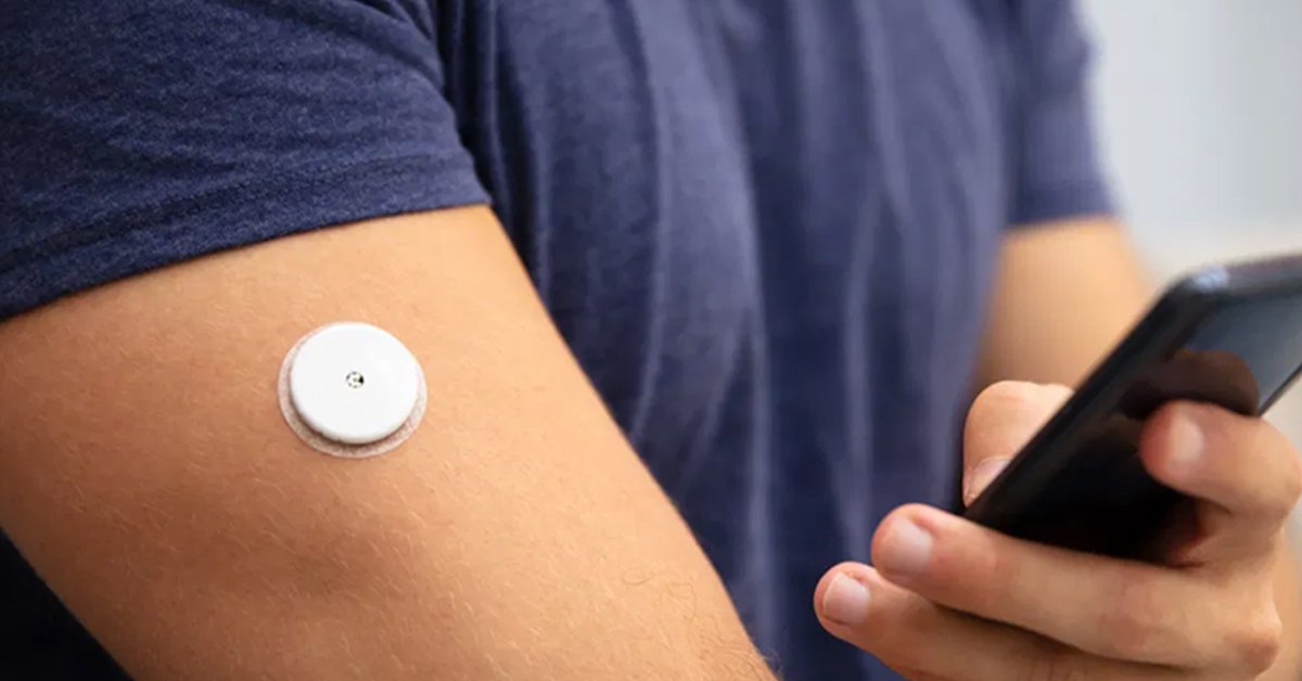 Continuous Glucose Monitoring