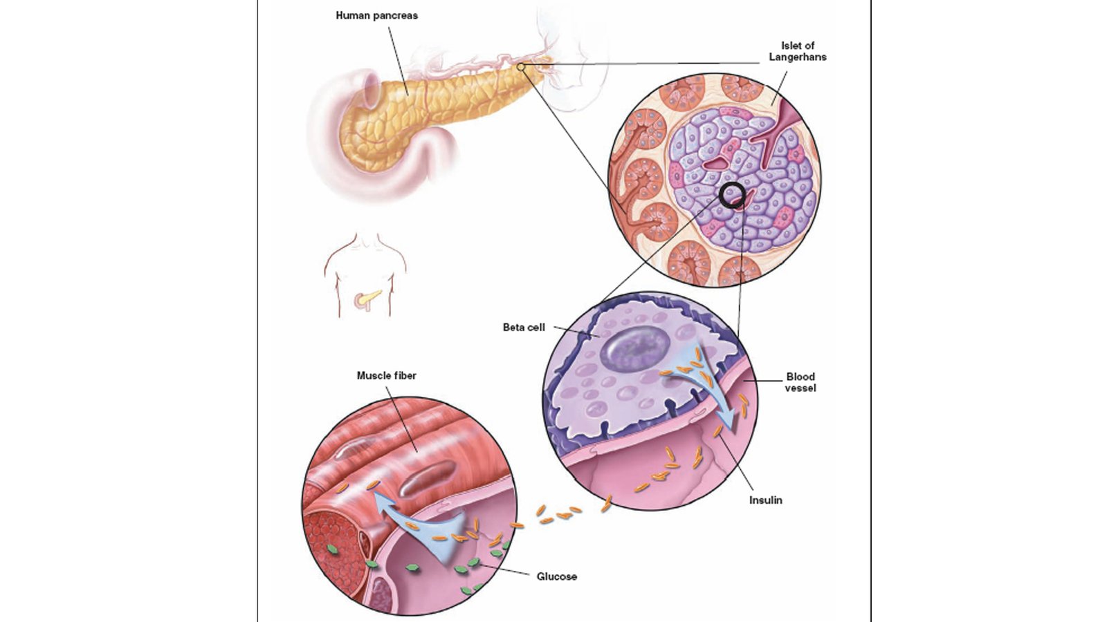 Stem Cell Therapy