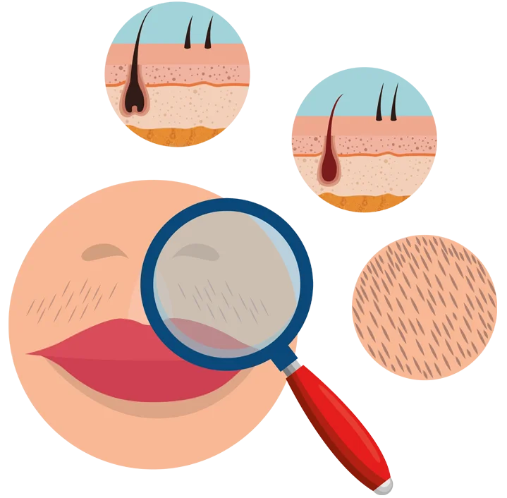 Hirsutism Clinical Assessment Chart
