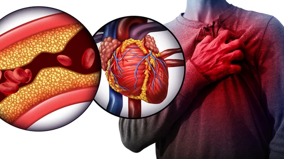 Cardiovascular Disease