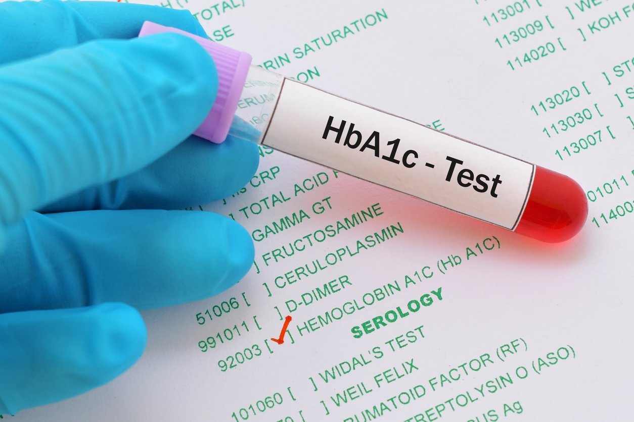 HbA1c Test