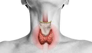 Hashimoto's Thyroiditis