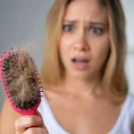 PCOS and Hair Loss: Hormonal Solutions with Dr. Ali in Dubai
