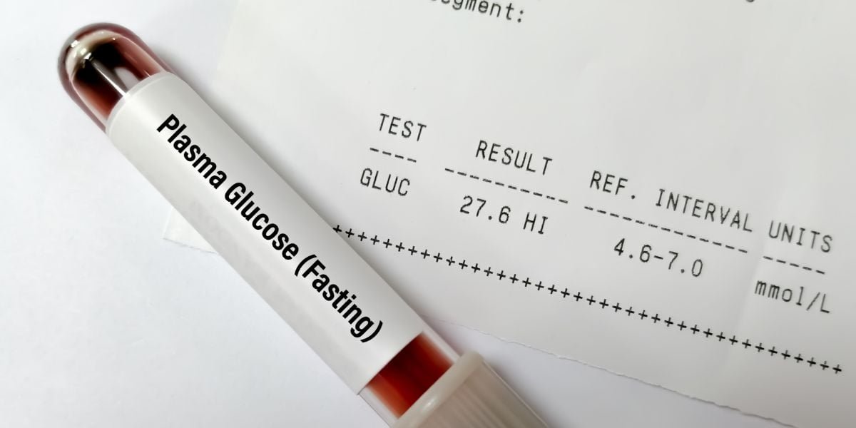 Fasting Plasma Glucose