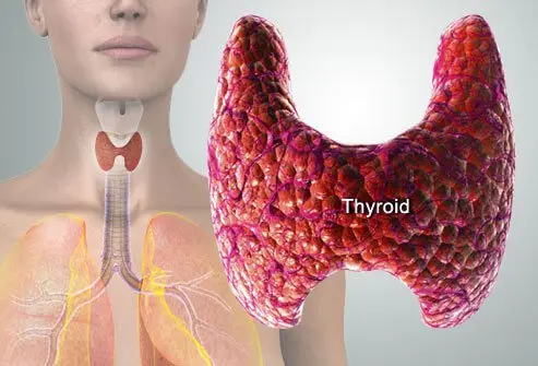 Hyperthyroidism