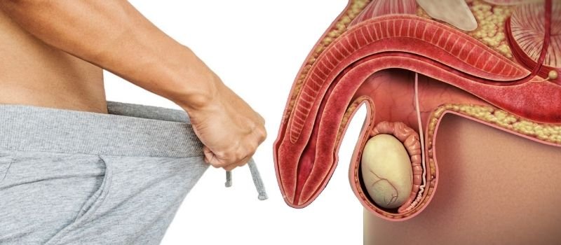 Erectile Dysfunction