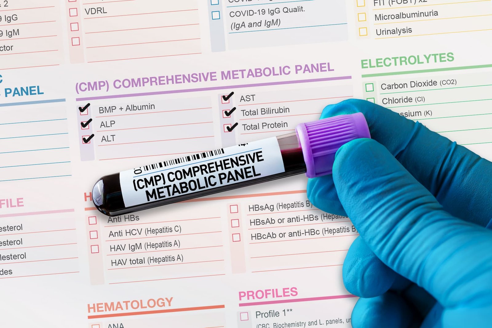 Metabolic Panel