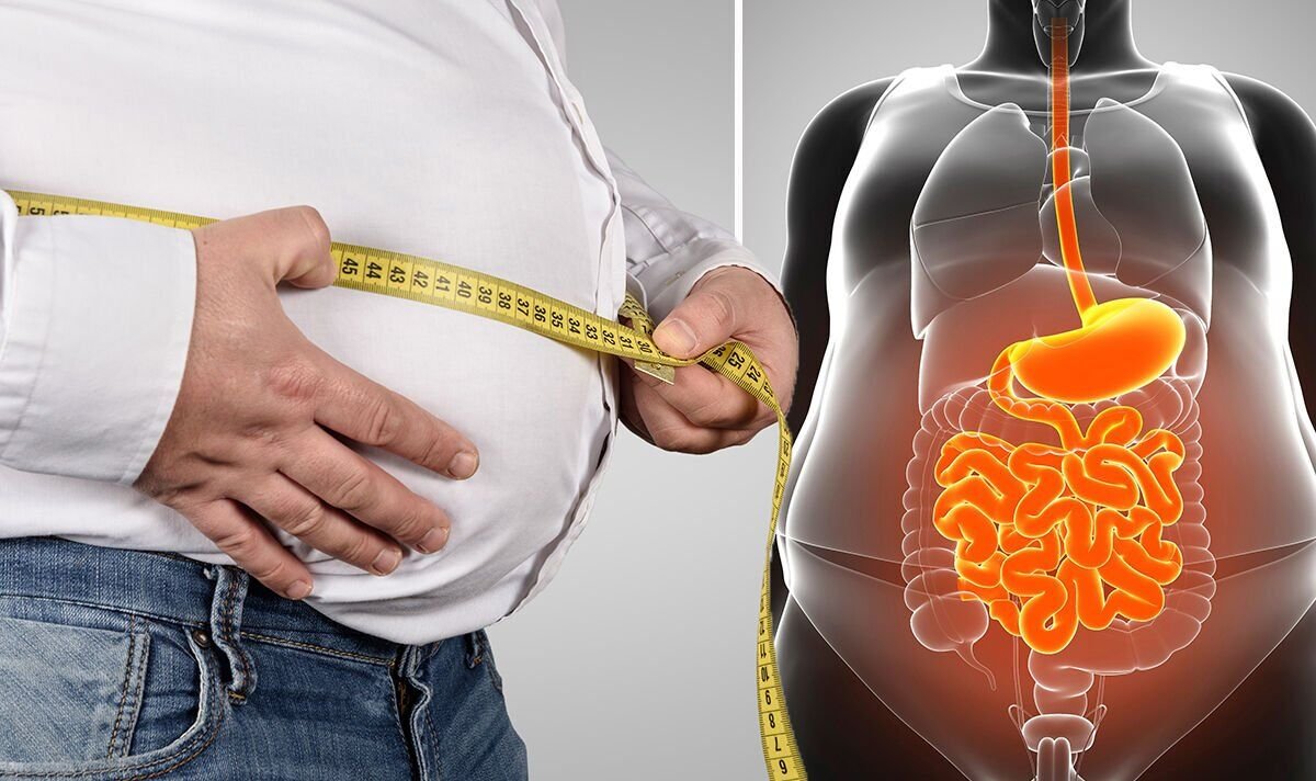 Obesity and Visceral Fat