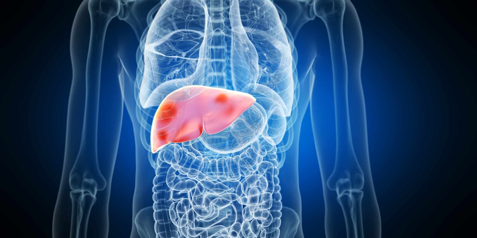 Fatty Liver Cellular Spectrum