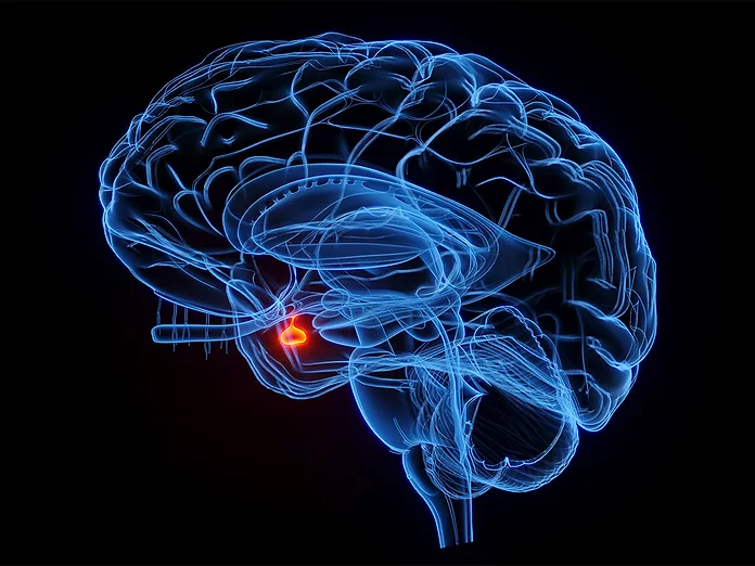What Is Acromegaly?
