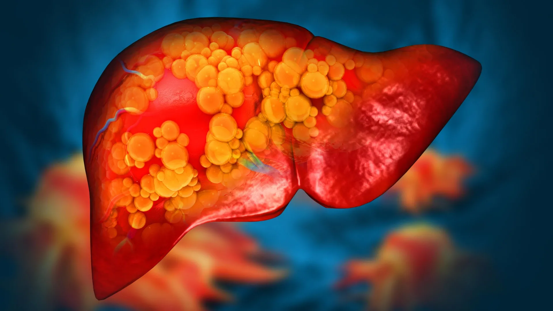 Human Liver Organ Damage