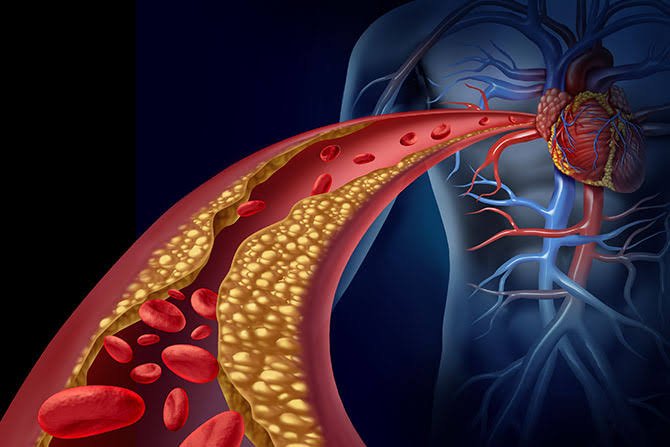Cardiovascular Disease Risk Factor