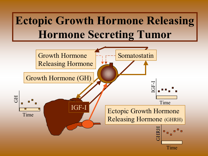 Ectopic Growth Hormone-Releasing Hormone Secretion